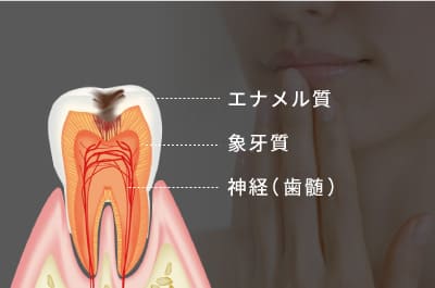 エナメル質・象牙質・神経（歯髄）